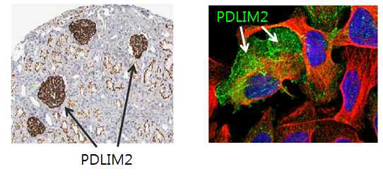 신장 조직 및 세포에서 PDLIM2의 발현 양상 (면역염색 결과)