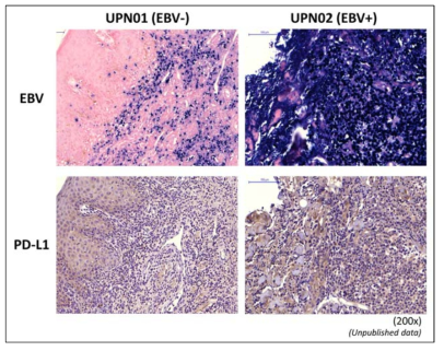 EBV 연관 림프종 환자 조직에서 EBV와 PD-L1의 발현 비교