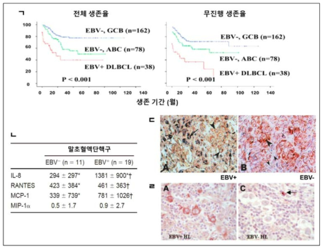 EBV 양성 종양의 특징