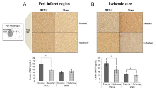 IHC 결과 IHC를 통해 rat MCAO 모델에서 유산소운동에 따른 신경 재생 여부를 확인. rat 모델의 penumbra 영역에서의 MIF, BDNF의 발현양상을 확인한 결과 2주 동안 운동한 그룹 > 1주동안 운동한 그룹 > 운동을 하지 않은 그룹 순으로 발현됨. MRI/DTI 뿐만 아니라 IHC에서의 실제 MIF, BDNF 발현양상을 확인한 결과 운동에 의해 MIF, BDNF가 증가하였음