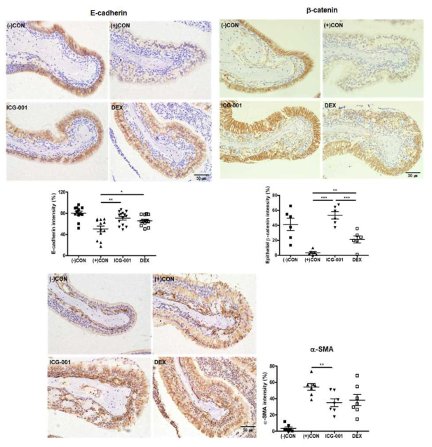 비강 폴립 마우스에서 EMT (epithelial to mesenchymal transition)에 대한 WNT 억제제, ICG-001의 효과 (E-cadherin/b-catenin(상)과 a-smooth muscle actin (a-SMA)(하) 발현)