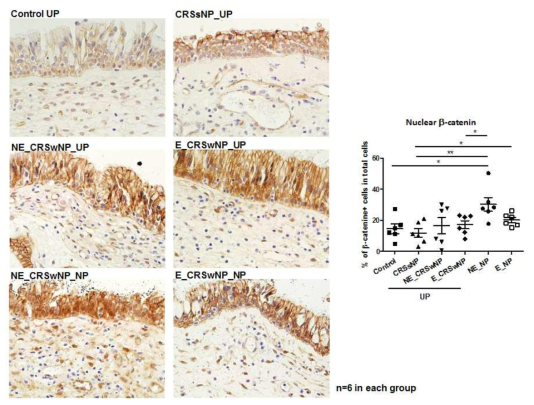 비강 폴립 human sample에서 핵으로 이동된 beta-catenin 관찰