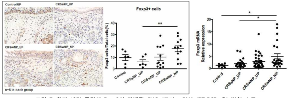 환자 비강 폴립의 Foxp3의 단백질 (IHC, 좌)과 mRNA (RT-PCR, 우) 발현 수준