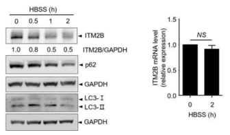 유방암 세포주에 HBSS를 처리하여 절식상태를 만든 후 Western blotting과 q PCR을 이용하여 ITM2B 단백질과 mRNA양이 감소됨을 확인