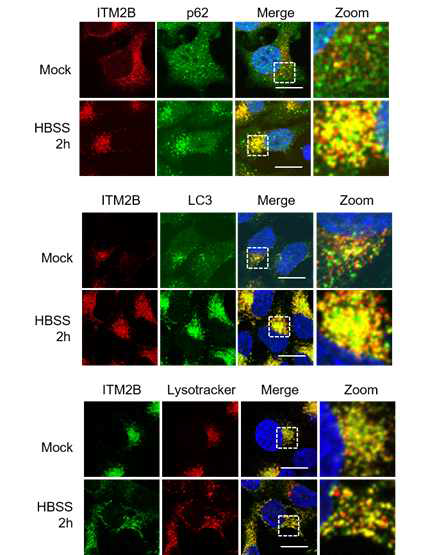 공초점 현미경을 통해 ITM2B가 절식상태에서 p62와 LC3와 같이 위치함을 확인. (위)
