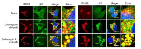 ITM2B 단백질이 자가포식 억제물질을 처리 했을 때 축적되고, LC3, p62 단백질도 축적되어 같이 존재함