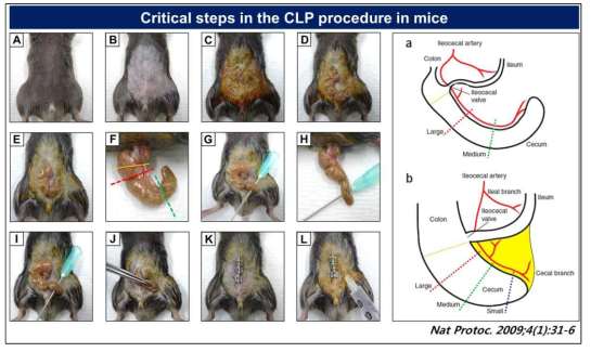 패혈증 유발 동물모델 구축을 위한 마우스 CLP 방법