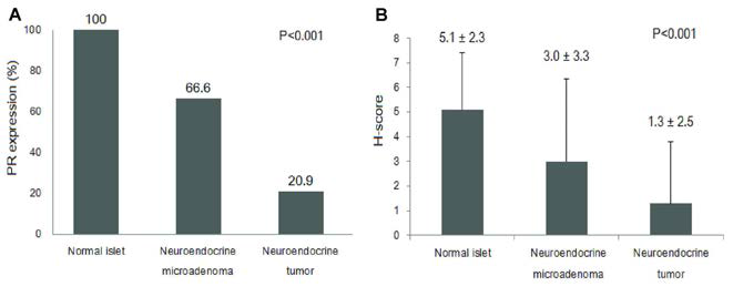 정상 췌장소도, 신경내분비미세선종, 췌장신경내분비 종양에서의 progesterone receptor (PR) 단백의 발현 정도 비교. PR 단백 발현에 대한 H-점수는 정상 췌장소도에서 5.1 ± 2.3, 신경내분비미세선종에서 3.0 ± 3.3, 췌장신경내분비 종양에서 1.3 ± 2.5 으로 세 군간 유의미한 차이를 보였음 (p<0.001)