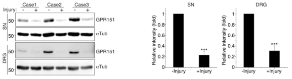 Mouse sciatic nerve에 손상을 가하고 72시간 뒤에 DRG 또는 sciatic nerve (SN)를 적출하여 GPR151단백질 수준을 western blot을 통해 확인함