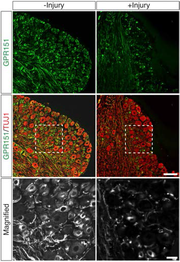 조직면역 형광염색을 통한 GPR151의 양적 변화. 신경 손상을 가한 후 72시간 뒤에(+Injury) GPR151의 DRG 조직 내 분포를 보면, DRG neuron의 ER 또는 세포막 그리고 axon shaft에서 발현 양이 감소하고 있음을 확인할 수 있음