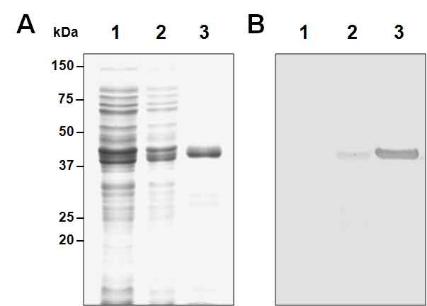 Productions of recombinant CsAP2 and anti-CsAP2