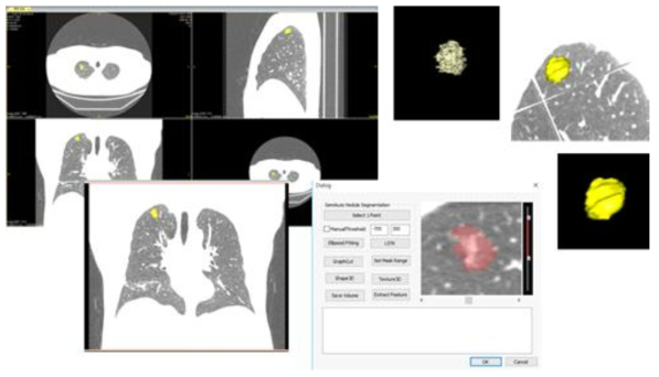 MPR, full screen, volume, surface view 등 사용자의 필요에 따라 다양하게 화면에 보여 주는 기능 개발함