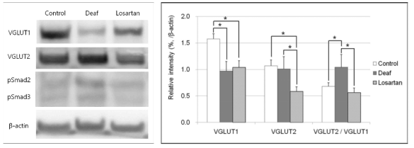 miR-376a-3p, miR-598-3p가 amyloid-β 투여 정상 청력군과 amyloid-β 투여 난청군에서 유의한 차이를 나타냄