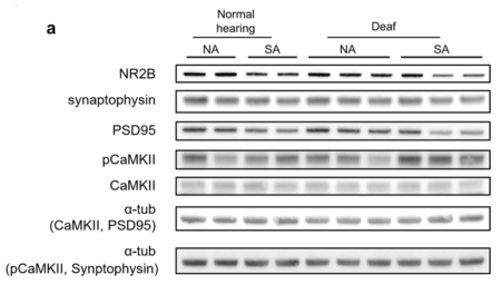 Hippocampus에서 synaptic marker에 대한 Western blot 결과