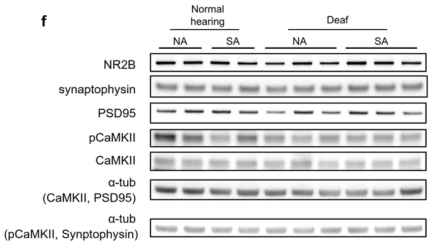 Prefrontal cortex에서 synaptic marker에 대한 Western blot 결과