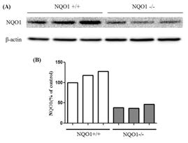 NADPH: quinone oxidoreductase (NQO1) knockdown in proximal tubular epithelial cells(HK2). HK2 cells were harvested 24h after si NQO1 or si scramble. Expression of NQO1 was observed using western blot analysis. Protein levels were determined by western blot analysis(A). Band intensities was quantified by densitometry and abjusted according to the respective β-actin band intensity (B)