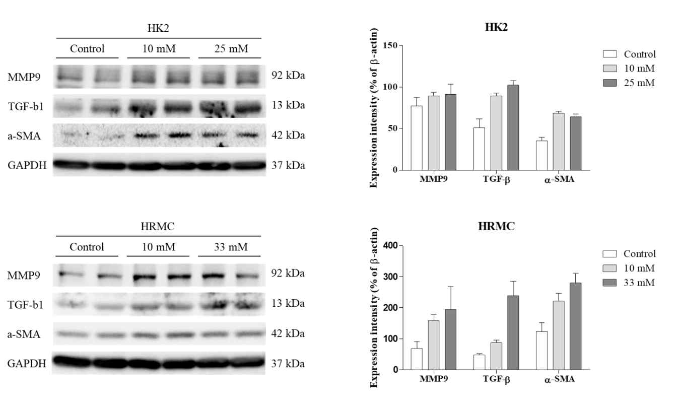 Profibrotic signal expression after high concentration glucose treatment in HK2 cells and human renal mesangial cells (HRMCs). HK2 cells and HRMCs were treated with various concentrations of glucose for 24 h, and the total cell lysates were subjected to western blotting. The expression intensities of profibrotic signal proteins (A, C) were determined by densitometry, and were normalized to those of glyceraldehyde 3-phosphate dehydrogenase (GAPDH) (B, D). Values are expressed as the means ± SD of triplicate experiments