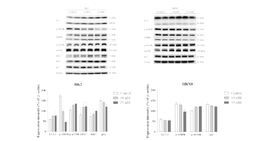 Autophagy-related protein expression following treatment of HK2 cells and human renal mesangial cells (HRMCs) with high concentrations of glucose. HK2 cells and HRMCs were treated with various concentrations of glucose for 24 h, and the total cell lysates were subjected to western blotting. The expression intensities of autophagy-related proteins (A, C) were determined by densitometry, and were normalized to those of β-actin (B, D). Values are expressed as the means ± SD of triplicate experiments