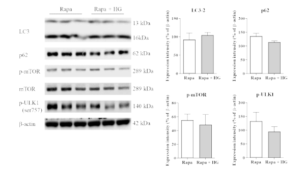 Treatment with high glucose concentrations enhanced mechanistic target of rapamycin (mTOR) suppression in HK2 cells. HK2 cells were pretreated with rapamycin (100 nM) for 12 h, and treated with glucose (25 mM) for 24 h. Total cell lysates were subjected to western blotting. The expression intensities of proteins (A) were determined by densitometry and were normalized to those of β-actin (B). Values are expressed as means ± SD of triplicate experiments