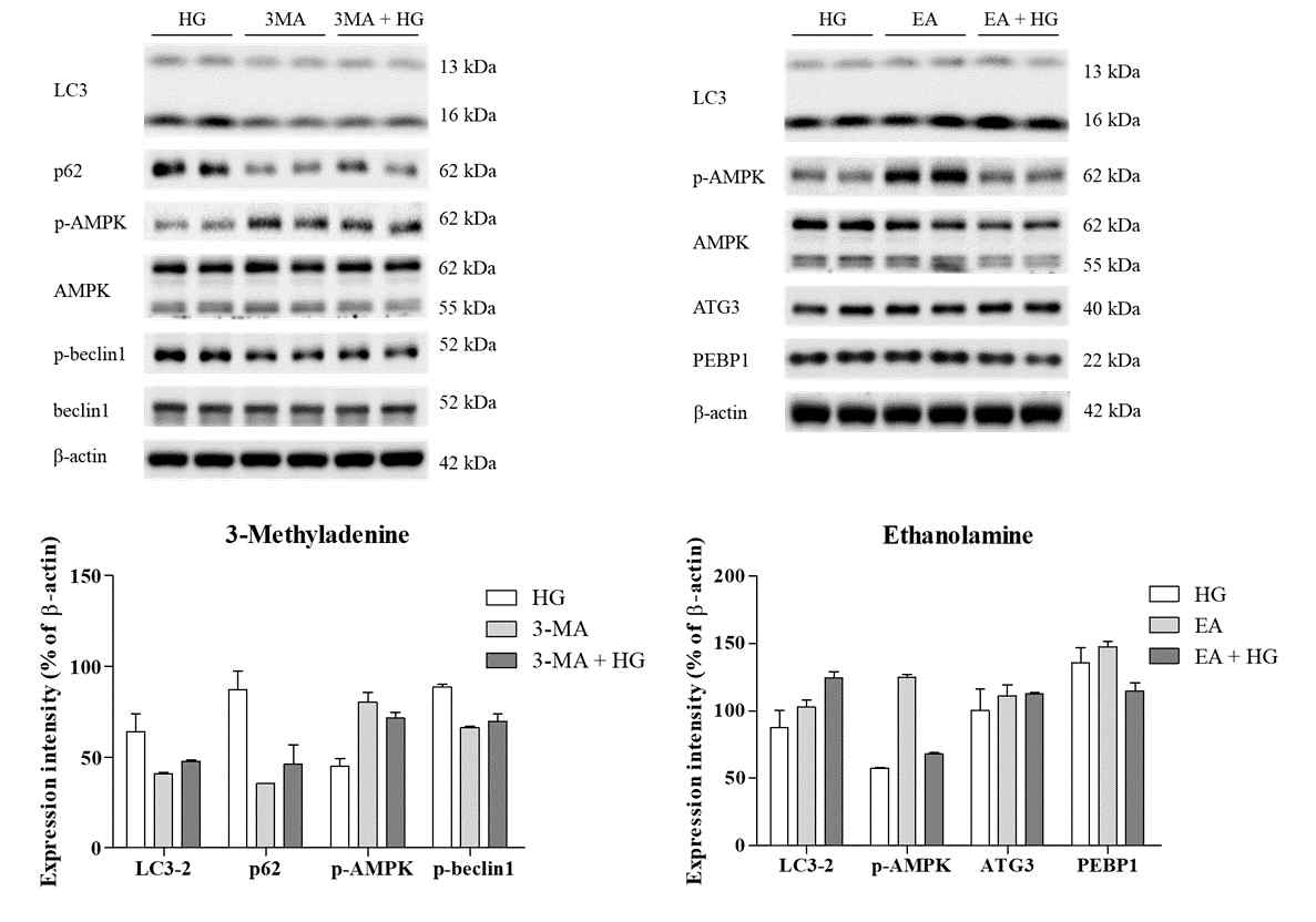 High glucose concentrations altered autophagosome expression in HK2 cells pretreated with 3-methyladenine (3MA) or ethanolamine (EA). HK2 cells were pretreated with 3MA (5 mM) or EA (10 mM) for 3 or 12 h, respectively. After pretreatment, the HK2 cells were treated with glucose (25 mM) for 24 h. Total cell lysates were subjected to western blotting. The expression intensities of proteins (A) were determined by densitometry, and were normalized to those of β-actin (B). Values are expressed as the means ± SD of triplicate experiments