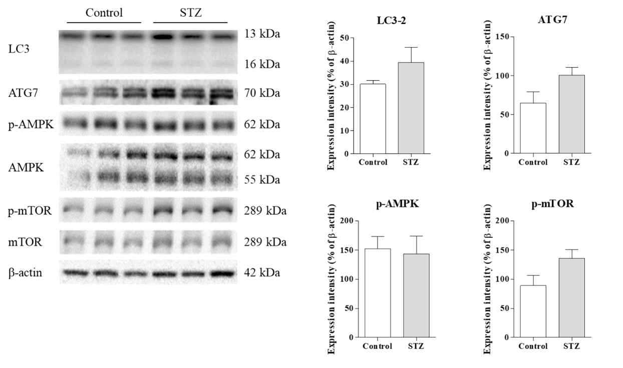 Autophagy-related protein expression in the kidney tissue of streptozotocin (STZ)-treated mice. C57BL/6N mice were injected with STZ (50 mg/kg) for 5 consecutive days. After 1 month, the C57BL/6N mice were sacrificed and their kidney tissues were subjected to western blot analysis. The tissue homogenates were analyzed for autophagy-related protein expression by western blot analysis (A). Band intensities were determined by densitometry and were normalized to those of β-actin (B). Values are expressed as the means ± SD of triplicate experiments