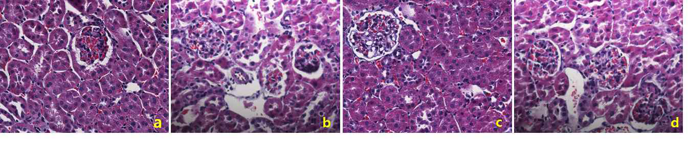 Effect of IL-17 knockout on kidney histopathology determined via Hematoxylin and Eosin (H&E) staining of tissue. C57BL/6N and IL-17 knockout mice were injected with STZ (50 mg/kg) for 5 consecutive days. After 3 month, the C57BL/6N and IL-17 knockout mice were sacrificed. Kidney tissue from wild type control (A) and NQO1 knockout control (C) groups showed normal histological patterns. After streptozotocin treatment, wild type STZ (B) and NQO1 knockout STZ (D) group displayed significant glomerular basement membrane thickening