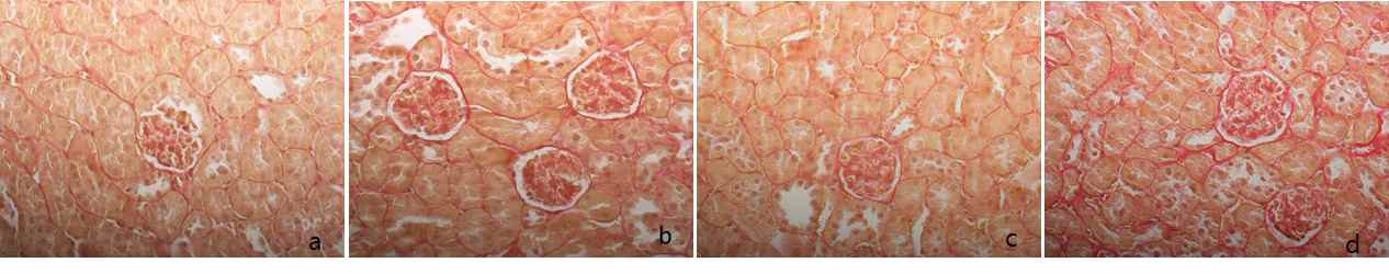 Effect of 17 knockout on kidney histopathology determined via Sirius red staining of tissue. C57BL/6N and IL-17 knockout mice were injected with STZ (50 mg/kg) for 5 consecutive days. After 3 month, the C57BL/6N and IL-17 knockout mice were sacrificed. Kidney tissue from wild type control (A) and NQO1 knockout control (C) groups showed normal histological patterns. After streptozotocin treatment, wild type STZ (B) and NQO1 knockout STZ (D) group displayed significant accumulation of collagen in glomerular basement membrane