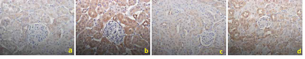 Effect of IL-17 knockout on kidney histopathology determined via LC3 immunohistochemistry staining of tissue. C57BL/6N and IL-17 knockout mice were injected with STZ (50 mg/kg) for 5 consecutive days. After 3 month, the C57BL/6N and IL-17 knockout mice were sacrificed. Kidney tissue from wild type control (A) and NQO1 knockout control (C) groups showed normal histological patterns. After streptozotocin treatment, LC3 positive were increased wild type STZ (B) and NQO1 knockout STZ (D) group. Diabetic IL-17-/- mice are relatively reduced LC3 positive cells compared WT diabetic mice