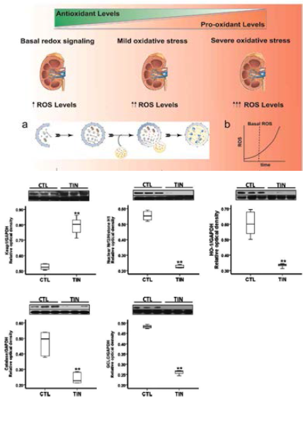 항산화효소의 발현과 tubulo-interstitial nephropathy와 의 관계