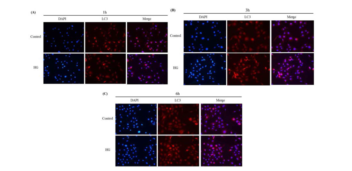 Expression of LC3 in high glucose treated proximal tubular epithelial cells(HK2). HK2 cells were harvested 1h, 3h and 6h after high glucose teratment(20mM). Expression of LC3 was observed using immunofluorescence. (A) 1h teratment by glucose concentration. (B) 3h treatment by glucose concentration. (C) 6h treatment by glucose concentration