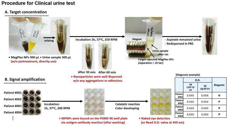 임상결핵환자의 urine에 대한 마그네토플라즈모닉 ELISA 진단의 실제 실험과정 및 진단 개념도