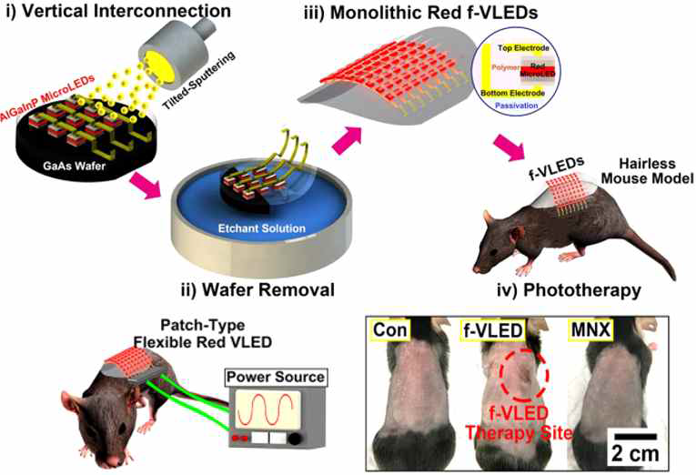 플렉서블 수직형 AlGaInP 마이크로 LED의 광자극을 유도해 쥐의 피부상에 모발 성장을 유도함