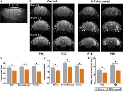 Representative T2-weighted magnetic resonance images and comparisons of cortical depth and hippocampal size between prenatally methylazoxymethanol acetate (MAM)-exposed rats and controls on postnatal day (P) 16 and P30