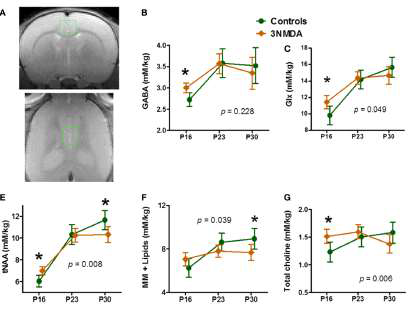 Neurochemical changes in rats with N-methyl-d-aspartate (NMDA)-induced spasms using 1H-MRS findings