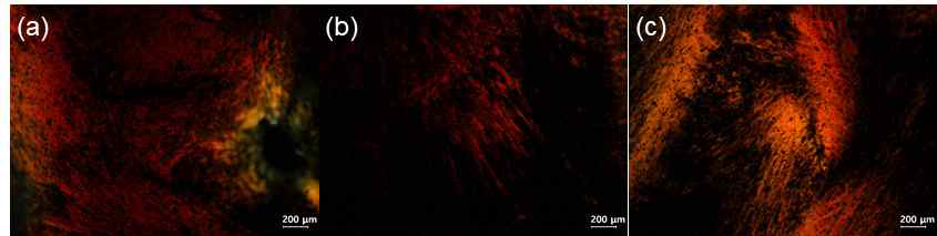 그림 6. (a) 1:0.1, (b) 1:0.25, (c) 1:0.5 (그래핀:작은 셀룰로오스 나노 결정) 작은 셀룰로오스 나노 결정과 그래핀산화물을 섞은 용액의 편광현미경 사진