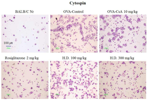 Photomicrograph (original magnification, x 400) of BALF cytospins from a sensitized mouse exposed repeatedly to allergen (OVA: 500 ㎍/ml, i.n. for 30 min/day on 3 days/week for 12 weeks at a flow rate of 250 L/min, 2.5% ovalbumin in normal saline). WT: Normal Balb/c mice,Con:Ovalbumin inhalation(control group), CsA:OVA+CsA(10 mg/kg), OVA + HD (100, 300 mg/kg), OVA+Rosiglitazone(2 mg/kg). *Oxidative stress(ROS 등)는 Th2-polarizing을 유도하는 것으로 밝혀짐.(The Journal of Immunolofy,2006, 176: 2765-2772.)