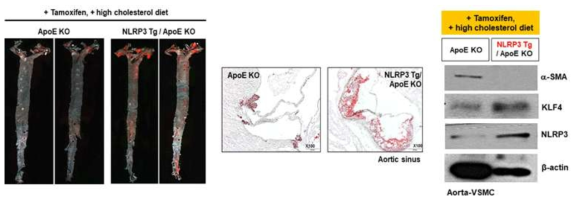 NLRP3 Tg/SM22-Cre/ApoE KO 마우스에서 동맥경화 표현형 분석 및 동맥경화 유발 기전 분석