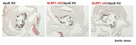 NLRP3 cKO/SM22-Cre/ApoE KO 마우스에서 동맥경화 표현형 분석