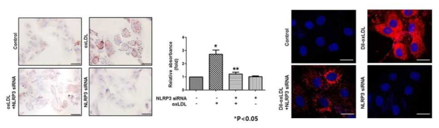 혈관평활근세포 foam cell 형성에 중요한 역할을 하는 NLRP3