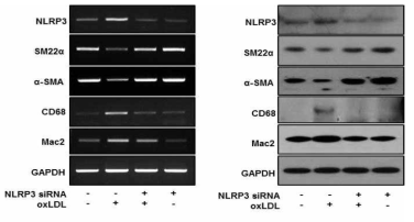 oxLDL에 의한 혈관평활근세포 표현형 전환에 관여하는 NLRP3 역할 분석(웨스턴블랏팅)