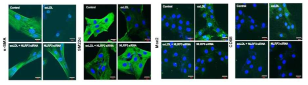 oxLDL에 의한 혈관평활근세포 표현형 전환에 관여하는 NLRP3 역할 분석 (형광면역염색법)