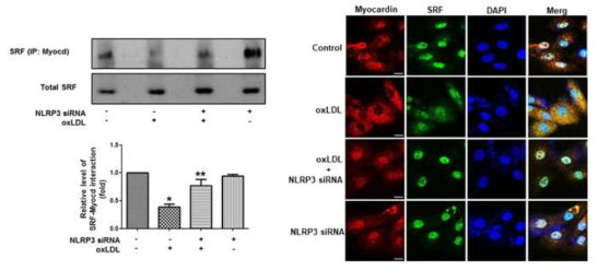 oxLDL에 의한 myocardin-SRF 결합변화 및 이에 미치는 NLRP3의 영향 분석