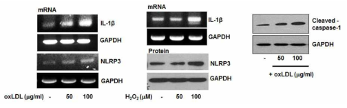 혈관세포에서 NLRP3 inflammasome 활성화 분석