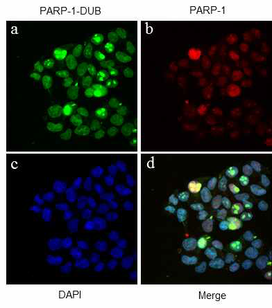 PARP-1-DUB과 PARP1이 결합함을 co-localization study를 통해 확인