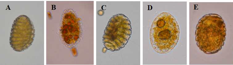 저서 와편모류 Polykrikos lebourae가 다양한 먹이를 섭식하는 장면. (A) Polykrikos lebourae, (B) 먹이 Amphidibnium massatii, (C) 먹이 Symbiodinium voratum, (D) 먹이 Thecadinium kofoidii, (E) 먹이 Prorocentrum lima