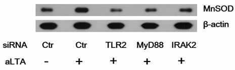 siRNA가 형질전환된 세포에서 aLTA에 의한 MnSOD 발현변화 확인