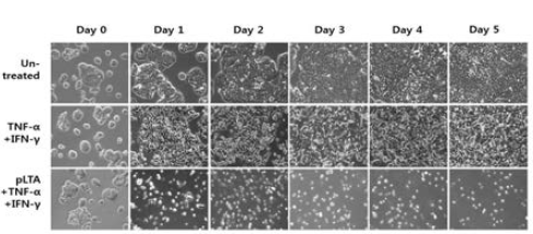 pLTI에 의한 HT-29 대장암 세포의 자가사멸; 반면 TI는 세포의 사멸을 유도하지 못함