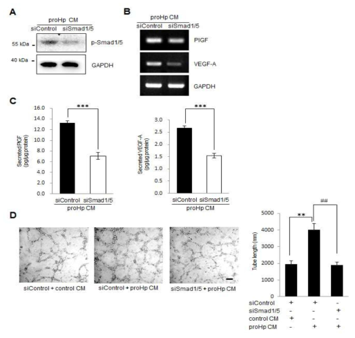 ProHp-induced PlGF-dependent angiogenesis 기전에 전사인자 Smad1,5의 중요성