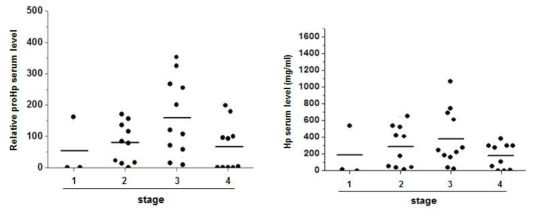 ProHp and Hp levels in sera of HCC of stage 1, 2, 3, or 4