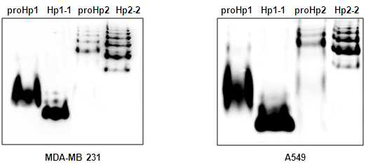 ProHp 와 Hp의 electrophoretic mobility 차이